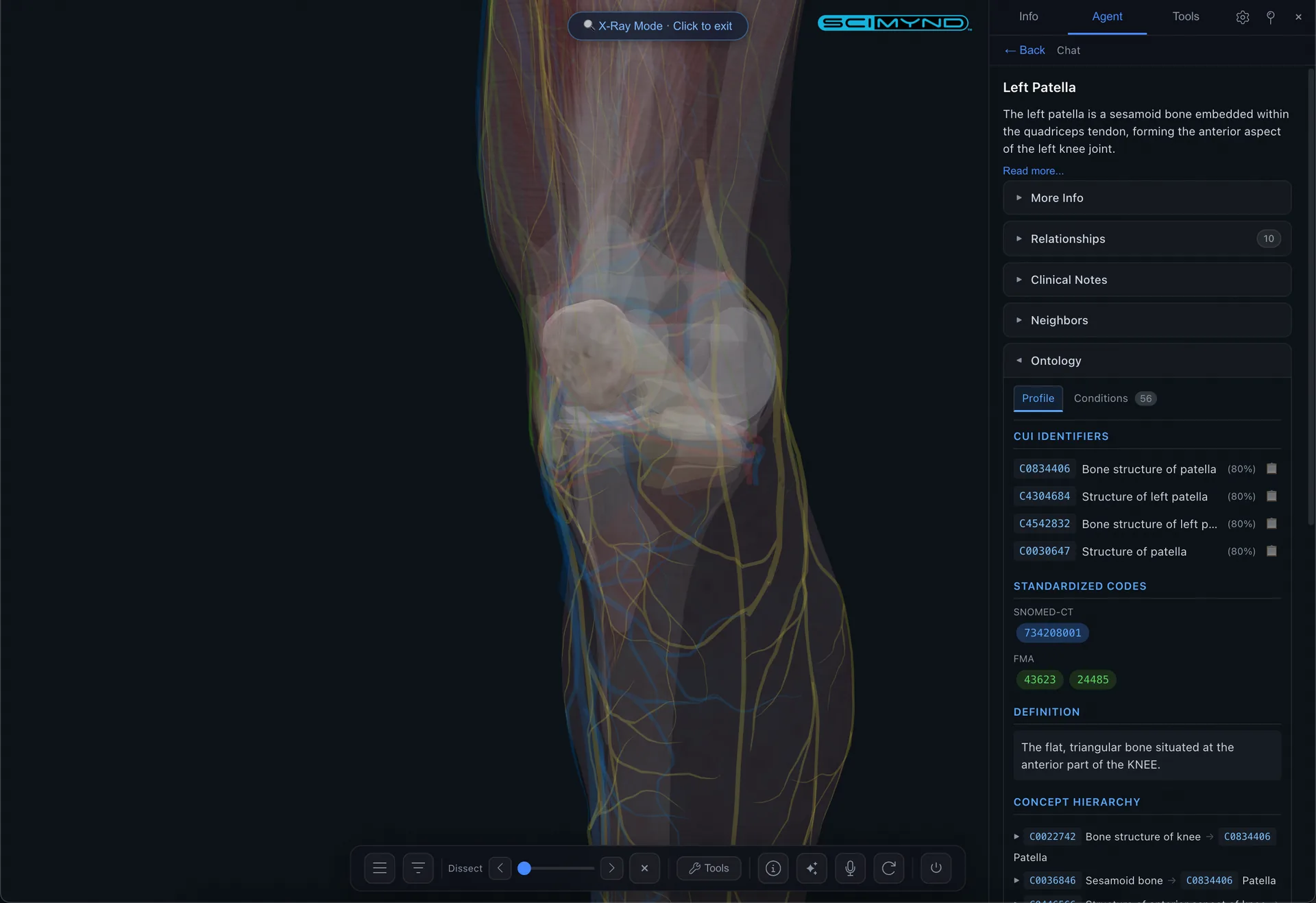 X Ray detail view