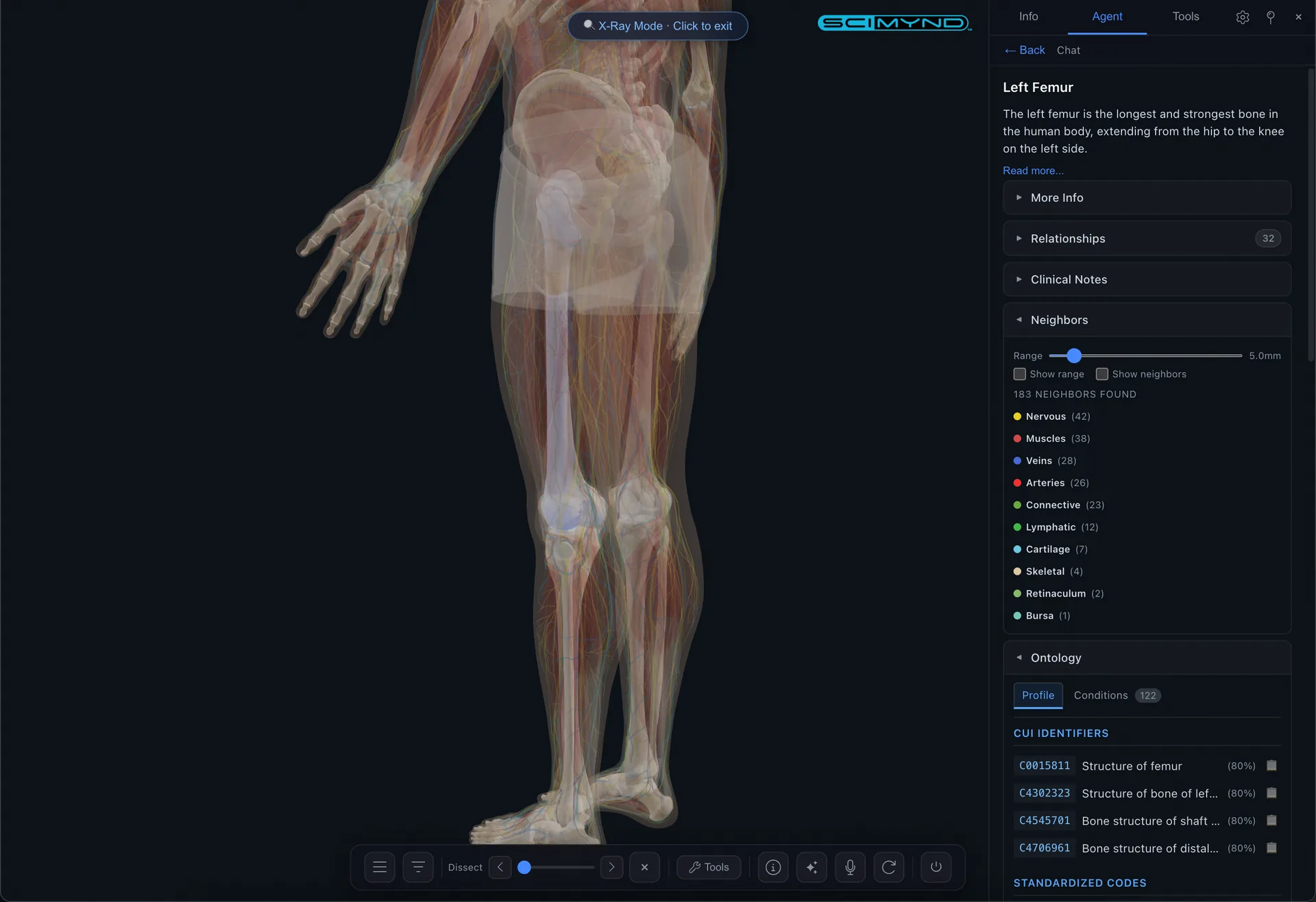 X Ray mode with neighbors